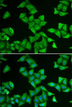 Immunocytochemistry/ Immunofluorescence: COX5A Antibody [NBP3-38264] - Immunofluorescence analysis of U2OS cells using COX5A Rabbit pAb. Secondary antibody: Cy3-conjugated Goat anti-Rabbit IgG (H+L) at 1:500 dilution. Blue: DAPI for nuclear staining.