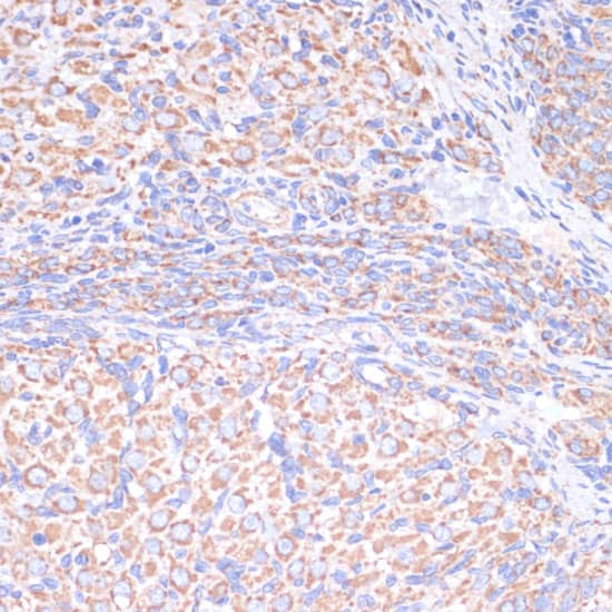 Immunohistochemistry: COX5A Antibody [NBP3-38264] - Immunohistochemistry analysis of paraffin-embedded Rat ovary using COX5A Rabbit pAb at dilution of 1:100 (40x lens). Microwave antigen retrieval performed with 0.01M PBS Buffer (pH 7.2) prior to IHC staining.