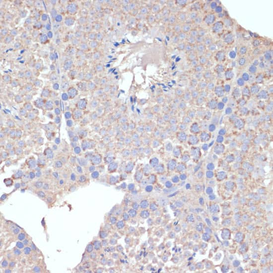 Immunohistochemistry: COX5A Antibody [NBP3-38264] - Immunohistochemistry analysis of paraffin-embedded Mouse testis using COX5A Rabbit pAb at dilution of 1:100 (40x lens). Microwave antigen retrieval performed with 0.01M PBS Buffer (pH 7.2) prior to IHC staining.