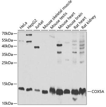 Western Blot: COX5A Antibody [NBP3-38264] - Western blot analysis of various lysates using COX5A Rabbit pAb at 1:1000 dilution.Secondary antibody: HRP-conjugated Goat anti-Rabbit IgG (H+L) at 1:10000 dilution.Lysates/proteins: 25ug per lane.Blocking buffer: 3% nonfat dry milk in TBST.Detection: ECL Basic Kit.Exposure time: 30s.