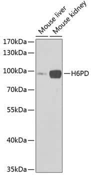 Western Blot: Glucose 1-dehydrogenase Antibody [NBP3-38265] - Western blot analysis of various lysates using Glucose 1-dehydrogenase Rabbit pAb at 1:1000 dilution.Secondary antibody: HRP-conjugated Goat anti-Rabbit IgG (H+L) at 1:10000 dilution.Lysates/proteins: 25ug per lane.Blocking buffer: 3% nonfat dry milk in TBST.Detection: ECL Enhanced Kit.Exposure time: 90s.