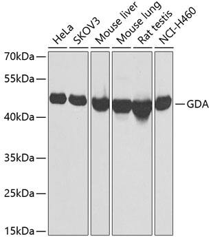 Western Blot: Guanine deaminase Antibody [NBP3-38266] - Western blot analysis of various lysates using Guanine deaminase Rabbit pAb at 1:1000 dilution.Secondary antibody: HRP-conjugated Goat anti-Rabbit IgG (H+L) at 1:10000 dilution.Lysates/proteins: 25ug per lane.Blocking buffer: 3% nonfat dry milk in TBST.Detection: ECL Basic Kit.Exposure time: 30s.