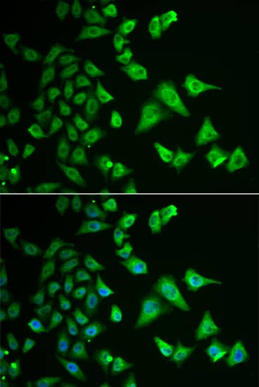 Immunocytochemistry/ Immunofluorescence: DHRS2 Antibody [NBP3-38268] - Immunofluorescence analysis of HeLa cells using DHRS2 Rabbit pAb. Secondary antibody: Cy3-conjugated Goat anti-Rabbit IgG (H+L) at 1:500 dilution. Blue: DAPI for nuclear staining.