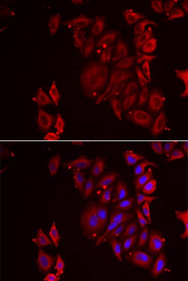 Immunocytochemistry/ Immunofluorescence: ADE2 Antibody [NBP3-38269] - Immunofluorescence analysis of U2OS cells using ADE2 Rabbit pAb. Secondary antibody: Cy3-conjugated Goat anti-Rabbit IgG (H+L) at 1:500 dilution. Blue: DAPI for nuclear staining.