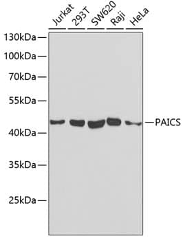 Western Blot: ADE2 Antibody [NBP3-38269] - Western blot analysis of various lysates using ADE2 Rabbit pAb at 1:1000 dilution.Secondary antibody: HRP-conjugated Goat anti-Rabbit IgG (H+L) at 1:10000 dilution.Lysates/proteins: 25ug per lane.Blocking buffer: 3% nonfat dry milk in TBST.Detection: ECL Basic Kit.Exposure time: 30s.