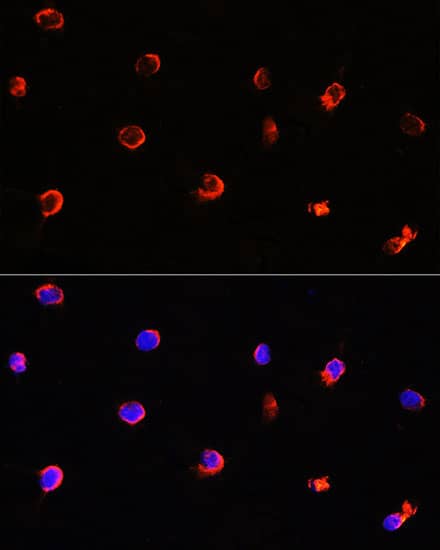 Immunocytochemistry/ Immunofluorescence: AIPL1 Antibody [NBP3-38272] - Immunofluorescence analysis of Y79 cells using AIPL1 Rabbit pAb at dilution of 1:100. Blue: DAPI for nuclear staining.