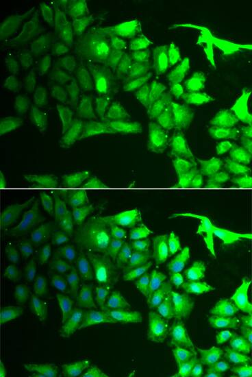 Immunocytochemistry/ Immunofluorescence: AIPL1 Antibody [NBP3-38272] - Immunofluorescence analysis of HeLa cells using AIPL1 Rabbit pAb. Secondary antibody: Cy3-conjugated Goat anti-Rabbit IgG (H+L) at 1:500 dilution. Blue: DAPI for nuclear staining.