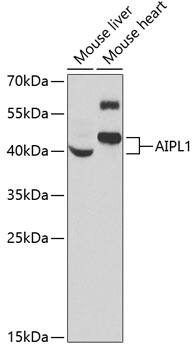 Western Blot: AIPL1 Antibody [NBP3-38272] - Western blot analysis of various lysates using AIPL1 Rabbit pAb at 1:1000 dilution.Secondary antibody: HRP-conjugated Goat anti-Rabbit IgG (H+L) at 1:10000 dilution.Lysates/proteins: 25ug per lane.Blocking buffer: 3% nonfat dry milk in TBST.Detection: ECL Basic Kit.Exposure time: 90s.