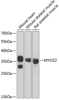Western Blot: Myozenin 2 Antibody [NBP3-38274] - Western blot analysis of various lysates using Myozenin 2 Rabbit pAb at 1:1000 dilution.Secondary antibody: HRP-conjugated Goat anti-Rabbit IgG (H+L) at 1:10000 dilution.Lysates/proteins: 25ug per lane.Blocking buffer: 3% nonfat dry milk in TBST.Detection: ECL Basic Kit.Exposure time: 10s.