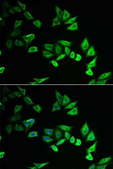 Immunocytochemistry/ Immunofluorescence: Myozenin 2 Antibody [NBP3-38274] - Immunofluorescence analysis of U2OS cells using Myozenin 2 Rabbit pAb. Secondary antibody: Cy3-conjugated Goat anti-Rabbit IgG (H+L) at 1:500 dilution. Blue: DAPI for nuclear staining.