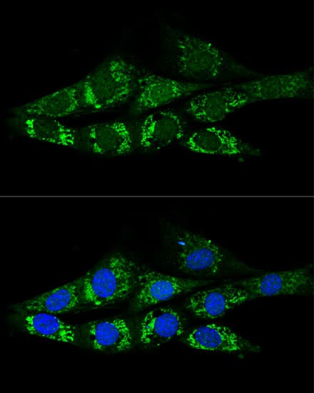 Immunocytochemistry/ Immunofluorescence: Acetyl CoA synthetase Antibody [NBP3-38275] - Confocal immunofluorescence analysis of NIH-3T3 cells using Acetyl CoA synthetase Rabbit pAb at dilution of 1:200. Blue: DAPI for nuclear staining.