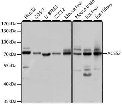 Western Blot: Acetyl CoA synthetase Antibody [NBP3-38275] - Western blot analysis of various lysates using Acetyl CoA synthetase Rabbit pAb at 1:1000 dilution.Secondary antibody: HRP-conjugated Goat anti-Rabbit IgG (H+L) at 1:10000 dilution.Lysates/proteins: 25ug per lane.Blocking buffer: 3% nonfat dry milk in TBST.Detection: ECL Basic Kit.Exposure time: 5s.