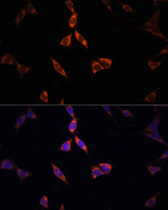 Immunocytochemistry/ Immunofluorescence: Acetyl CoA synthetase Antibody [NBP3-38275] - Immunofluorescence analysis of NIH-3T3 cells using Acetyl CoA synthetase Rabbit pAb at dilution of 100 (40x lens). Secondary antibody: Cy3-conjugated Goat anti-Rabbit IgG (H+L) at 1:500 dilution. Blue: DAPI for nuclear staining.