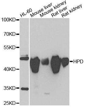 Western Blot: HPD Antibody [NBP3-38277] - Western blot analysis of various lysates using HPD Rabbit pAb at 1:1000 dilution.Secondary antibody: HRP-conjugated Goat anti-Rabbit IgG (H+L) at 1:10000 dilution.Lysates/proteins: 25ug per lane.Blocking buffer: 3% nonfat dry milk in TBST.Detection: ECL Enhanced Kit.Exposure time: 10s.