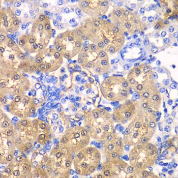 Immunohistochemistry: HPD Antibody [NBP3-38277] - Immunohistochemistry analysis of paraffin-embedded Rat kidney using HPD Rabbit pAb at dilution of 1:100 (40x lens). Microwave antigen retrieval performed with 0.01M PBS Buffer (pH 7.2) prior to IHC staining.