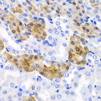 Immunohistochemistry: HPD Antibody [NBP3-38277] - Immunohistochemistry analysis of paraffin-embedded Mouse kidney using HPD Rabbit pAb at dilution of 1:100 (40x lens). Microwave antigen retrieval performed with 0.01M PBS Buffer (pH 7.2) prior to IHC staining.