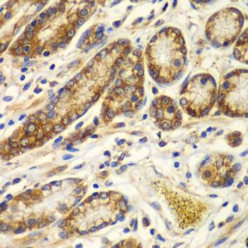 Immunohistochemistry: Calpain S1 Antibody [NBP3-38281] - Immunohistochemistry analysis of paraffin-embedded Human colon using Calpain S1 Rabbit pAb at dilution of 1:100 (40x lens). Microwave antigen retrieval performed with 0.01M PBS Buffer (pH 7.2) prior to IHC staining.