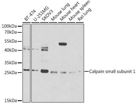 Western Blot: Calpain S1 Antibody [NBP3-38281] - Western blot analysis of various lysates using Calpain S1 Rabbit pAb at 1:1000 dilution.Secondary antibody: HRP-conjugated Goat anti-Rabbit IgG (H+L) at 1:10000 dilution.Lysates/proteins: 25ug per lane.Blocking buffer: 3% nonfat dry milk in TBST.Detection: ECL Basic Kit.Exposure time: 90s.