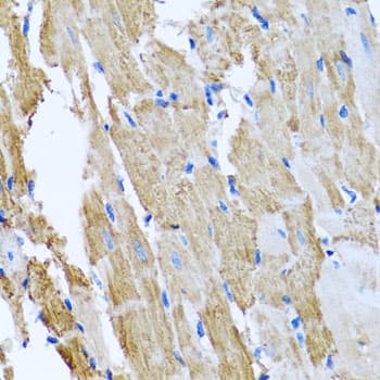 Immunohistochemistry: CCM2 Antibody [NBP3-38282] - Immunohistochemistry analysis of paraffin-embedded Rat heart using CCM2 Rabbit pAb at dilution of 1:100 (40x lens). Microwave antigen retrieval performed with 0.01M PBS Buffer (pH 7.2) prior to IHC staining.