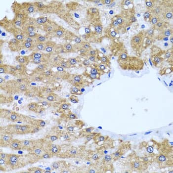 Immunohistochemistry: CCM2 Antibody [NBP3-38282] - Immunohistochemistry analysis of paraffin-embedded Human liver using CCM2 Rabbit pAb at dilution of 1:100 (40x lens). Microwave antigen retrieval performed with 0.01M PBS Buffer (pH 7.2) prior to IHC staining.