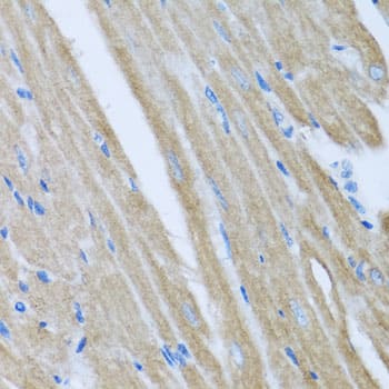 Immunohistochemistry: CCM2 Antibody [NBP3-38282] - Immunohistochemistry analysis of paraffin-embedded Mouse heart using CCM2 Rabbit pAb at dilution of 1:100 (40x lens). Microwave antigen retrieval performed with 0.01M PBS Buffer (pH 7.2) prior to IHC staining.