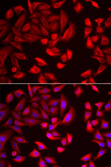 Immunocytochemistry/ Immunofluorescence: TCP1-beta Antibody [NBP3-38283] - Immunofluorescence analysis of HeLa cells using TCP1-beta Rabbit pAb. Secondary antibody: Cy3-conjugated Goat anti-Rabbit IgG (H+L) at 1:500 dilution. Blue: DAPI for nuclear staining.