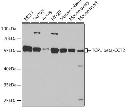 Western Blot: TCP1-beta Antibody [NBP3-38283] - Western blot analysis of various lysates using TCP1-beta Rabbit pAb at 1:1000 dilution.Secondary antibody: HRP-conjugated Goat anti-Rabbit IgG (H+L) at 1:10000 dilution.Lysates/proteins: 25ug per lane.Blocking buffer: 3% nonfat dry milk in TBST.Detection: ECL Basic Kit.Exposure time: 15s.