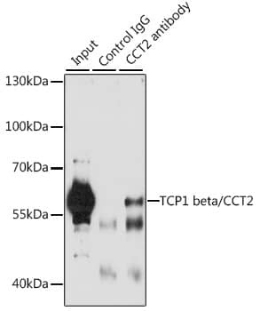 Immunoprecipitation: TCP1-beta Antibody [NBP3-38283] - Immunoprecipitation analysis of 200 ug extracts of A-549 cells, using 3 ug TCP1-beta antibody. Western blot was performed from the immunoprecipitate using TCP1-beta antibody at a dilution of 1:1000.