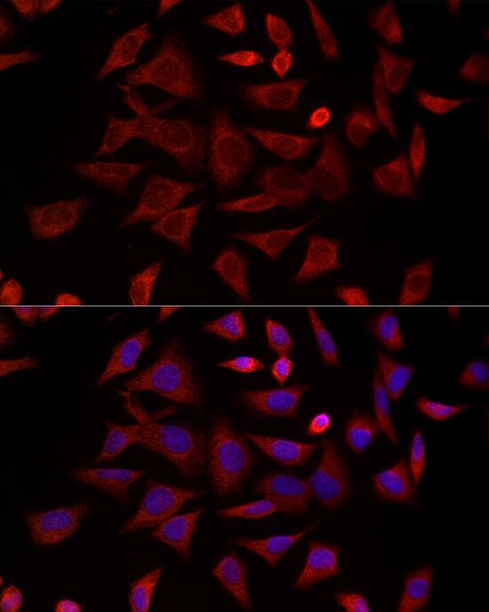 Immunocytochemistry/ Immunofluorescence TCP1-delta Antibody