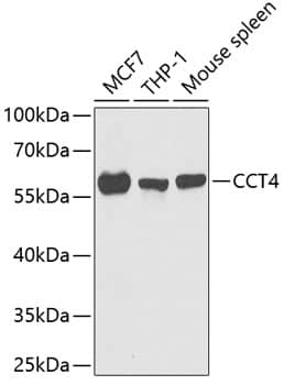 Western Blot TCP1-delta Antibody