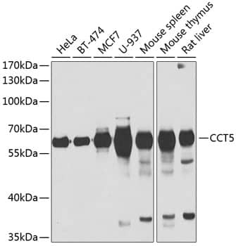 Western Blot: CCT5 Antibody [NBP3-38285] - Western blot analysis of various lysates using CCT5 Rabbit pAb at 1:1000 dilution.Secondary antibody: HRP-conjugated Goat anti-Rabbit IgG (H+L) at 1:10000 dilution.Lysates/proteins: 25ug per lane.Blocking buffer: 3% nonfat dry milk in TBST.Detection: ECL Basic Kit.Exposure time: 30s.