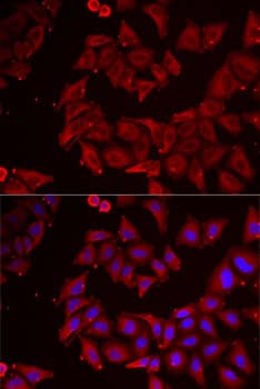 Immunocytochemistry/ Immunofluorescence: CMP kinase Antibody [NBP3-38287] - Immunofluorescence analysis of MCF7 cells using CMP kinase Rabbit pAb. Secondary antibody: Cy3-conjugated Goat anti-Rabbit IgG (H+L) at 1:500 dilution. Blue: DAPI for nuclear staining.