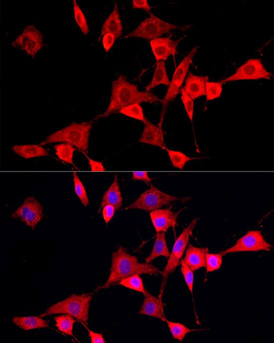 Immunocytochemistry/ Immunofluorescence CYP4V2 Antibody