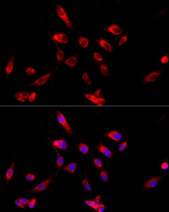 Immunocytochemistry/ Immunofluorescence CYP4V2 Antibody