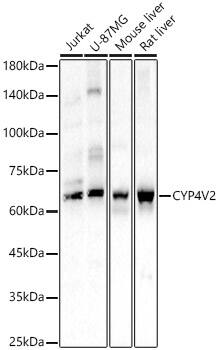 Western Blot CYP4V2 Antibody