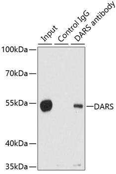 Immunoprecipitation: DARS Antibody [NBP3-38289] - Immunoprecipitation analysis of 200 ug extracts of 293T cells using DARS antibody. Western blot was performed from the immunoprecipitate using DARS antibody at a dilution of 1:1000.