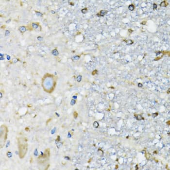 Immunohistochemistry: DARS Antibody [NBP3-38289] - Immunohistochemistry analysis of paraffin-embedded Mouse spinal cord using DARS Rabbit pAb at dilution of 1:100 (40x lens). Microwave antigen retrieval performed with 0.01M PBS Buffer (pH 7.2) prior to IHC staining.