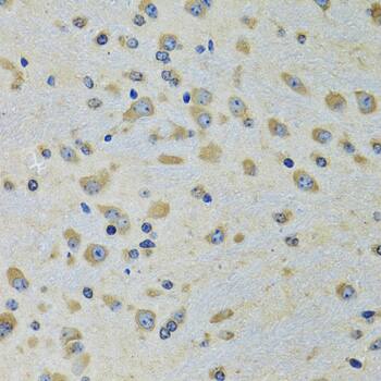 Immunohistochemistry: DARS Antibody [NBP3-38289] - Immunohistochemistry analysis of paraffin-embedded Rat brain using DARS Rabbit pAb at dilution of 1:100 (40x lens). Microwave antigen retrieval performed with 0.01M PBS Buffer (pH 7.2) prior to IHC staining.