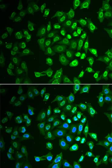 Immunocytochemistry/ Immunofluorescence: Fumarylacetoacetate hydrolase Antibody [NBP3-38291] - Immunofluorescence analysis of HepG2 cells using Fumarylacetoacetate hydrolase Rabbit pAb at dilution of 1:500 (40x lens). Secondary antibody: Cy3-conjugated Goat anti-Rabbit IgG (H+L) at 1:500 dilution. Blue: DAPI for nuclear staining.