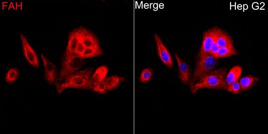 Western Blot: Fumarylacetoacetate hydrolase Antibody [NBP3-38291] - Western blot analysis of various lysates using Fumarylacetoacetate hydrolase Rabbit pAb at 1:10000 dilution. Secondary antibody: HRP-conjugated Goat anti-Rabbit IgG (H+L) at 1:10000 dilution. Lysates / proteins: 25 ug per lane. Blocking buffer: 3 % nonfat dry milk in TBST. Detection: ECL Basic Kit. Exposure time: 180s.