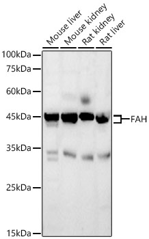 Western Blot: Fumarylacetoacetate hydrolase Antibody [NBP3-38291] - Western Blot analysis of various lysates using Fumarylacetoacetate hydrolase Rabbit pAb at 1:10000 dilution. Secondary antibody:HRP Goat Anti-Rabbit IgG (H+L)at 1:10000 dilution. Lysates / proteins: 25 ug per lane. Blocking buffer: 3 % nonfat dry milk in TBST. Detection:ECL Basic Kit. Exposuretime: 180s.