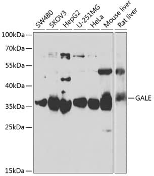 Western Blot: GALE Antibody [NBP3-38292] - Western blot analysis of various lysates using GALE Rabbit pAb at 1:1000 dilution.Secondary antibody: HRP-conjugated Goat anti-Rabbit IgG (H+L) at 1:10000 dilution.Lysates/proteins: 25ug per lane.Blocking buffer: 3% nonfat dry milk in TBST.Detection: ECL Basic Kit.Exposure time: 3s.