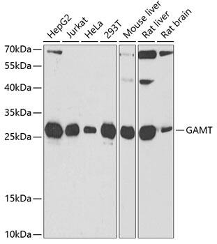 Western Blot: GAMT Antibody [NBP3-38293] - Western blot analysis of various lysates using GAMT Rabbit pAb at 1:1000 dilution.Secondary antibody: HRP-conjugated Goat anti-Rabbit IgG (H+L) at 1:10000 dilution.Lysates/proteins: 25ug per lane.Blocking buffer: 3% nonfat dry milk in TBST.Detection: ECL Basic Kit.Exposure time: 90s.