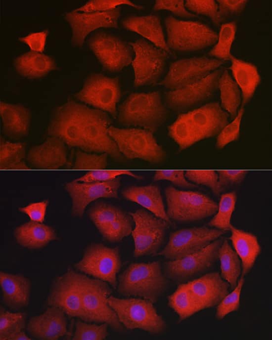 Immunocytochemistry/ Immunofluorescence: GAMT Antibody [NBP3-38293] - Immunofluorescence analysis of A549 cells using GAMT Rabbit pAb at dilution of 1:200 (40x lens). Secondary antibody: Cy3-conjugated Goat anti-Rabbit IgG (H+L) at 1:500 dilution. Blue: DAPI for nuclear staining.