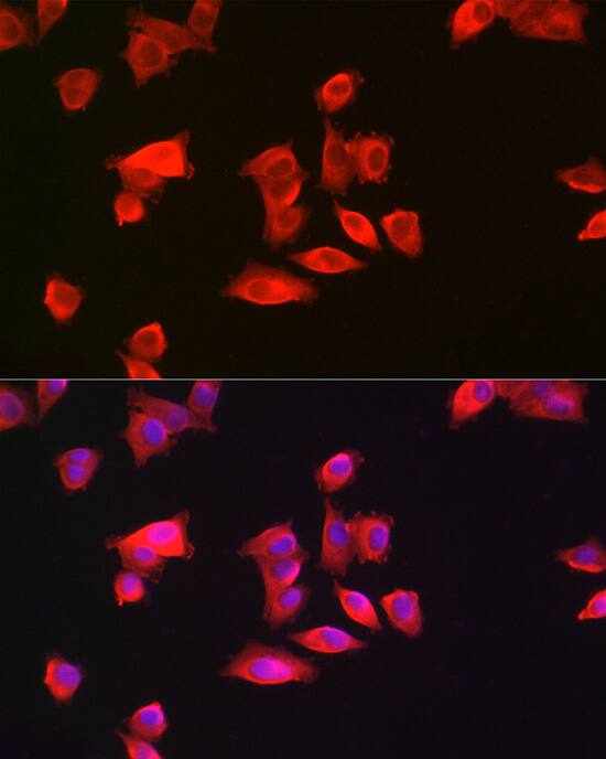 Immunocytochemistry/ Immunofluorescence: GAMT Antibody [NBP3-38293] - Immunofluorescence analysis of Hep G2 cells using GAMT Rabbit pAb at dilution of 1:200 (40x lens). Secondary antibody: Cy3-conjugated Goat anti-Rabbit IgG (H+L) at 1:500 dilution. Blue: DAPI for nuclear staining.