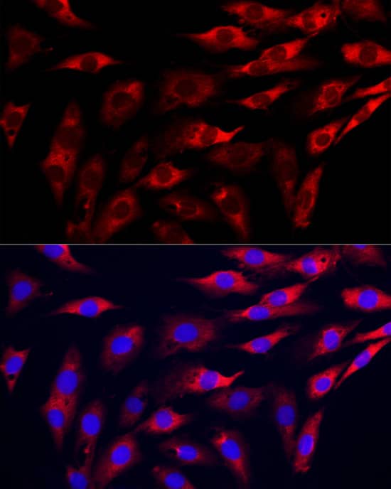 Immunocytochemistry/ Immunofluorescence GAMT Antibody