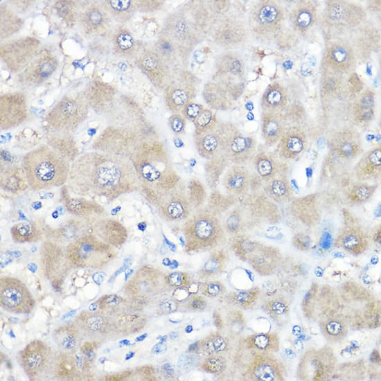 Immunohistochemistry: GAMT Antibody [NBP3-38293] - Immunohistochemistry analysis of paraffin-embedded Human liver using GAMT Rabbit pAb at dilution of 1:500 (40x lens). High pressure antigen retrieval performed with 0.01M Citrate Bufferr (pH 6.0) prior to IHC staining.