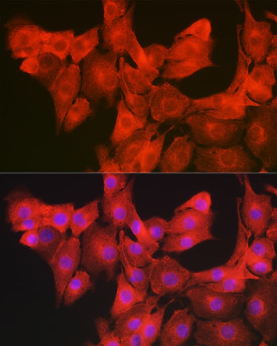 Immunocytochemistry/ Immunofluorescence GAMT Antibody