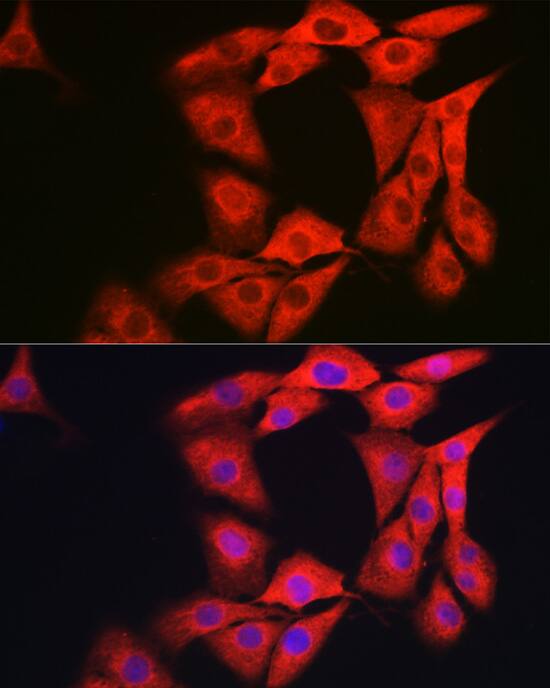 Immunocytochemistry/ Immunofluorescence: GAMT Antibody [NBP3-38293] - Immunofluorescence analysis of NIH-3T3 cells using GAMT Rabbit pAb at dilution of 1:200 (40x lens). Secondary antibody: Cy3-conjugated Goat anti-Rabbit IgG (H+L) at 1:500 dilution. Blue: DAPI for nuclear staining.