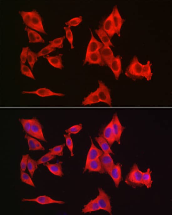 Immunocytochemistry/ Immunofluorescence GAMT Antibody